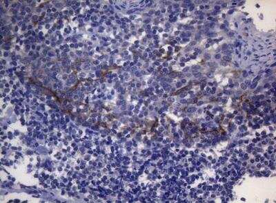 Immunohistochemistry-Paraffin SNX10 Antibody (OTI6B7)