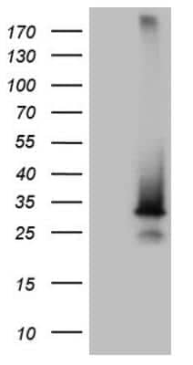 Western Blot SNX10 Antibody (OTI6B7)