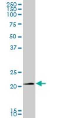 Western Blot: SNX10 Antibody [H00029887-B01P] - Analysis of SNX10 expression in human kidney.