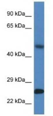 Western Blot: SNX10 Antibody [NBP1-79562] - Mouse Heart Lysate 1ug/ml  Gel Concentration 12%