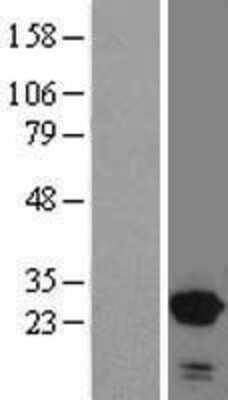 Western Blot: SNX10 Overexpression Lysate (Adult Normal) [NBL1-16301] Left-Empty vector transfected control cell lysate (HEK293 cell lysate); Right -Over-expression Lysate for SNX10.