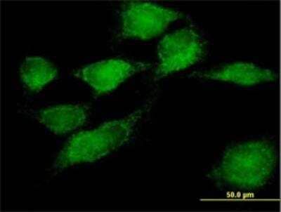 Immunocytochemistry/Immunofluorescence: SNX11 Antibody [H00029916-B02P] - Immunofluorescence of purified MaxPab antibody to SNX11 on HeLa cell. [antibody concentration 10 ug/ml]