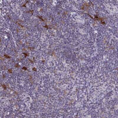 Immunohistochemistry: SNX11 Antibody [NBP2-38732] - Staining of human tonsil shows strong positivity in a subset of cells.