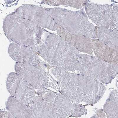 Immunohistochemistry-Paraffin: SNX11 Antibody [NBP1-85825] - Staining of human skeletal muscle shows no positivity in myocytes as expected.