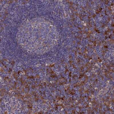 Immunohistochemistry-Paraffin: SNX11 Antibody [NBP1-85825] - Staining of human lymph node shows strong cytoplasmic positivity in non-germinal center cells.