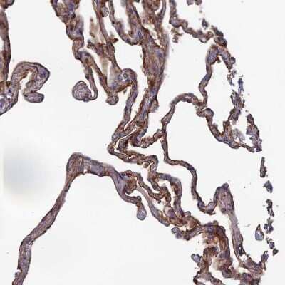 Immunohistochemistry-Paraffin: SNX11 Antibody [NBP1-85825] - Staining of human lung shows moderate membranous positivity in pneumocytes.
