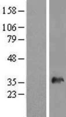 Western Blot: SNX11 Overexpression Lysate (Adult Normal) [NBL1-16302] Left-Empty vector transfected control cell lysate (HEK293 cell lysate); Right -Over-expression Lysate for SNX11.