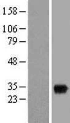 Western Blot: SNX11 Overexpression Lysate (Adult Normal) [NBL1-16303] Left-Empty vector transfected control cell lysate (HEK293 cell lysate); Right -Over-expression Lysate for SNX11.