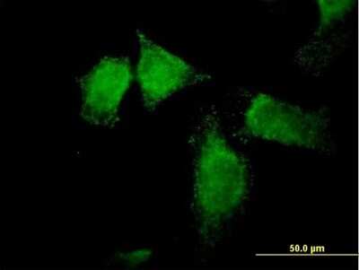 Immunocytochemistry/Immunofluorescence: SNX13 Antibody [H00023161-B01P] - Analysis of purified antibody to SNX13 on HeLa cell. (antibody concentration 10 ug/ml)