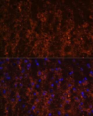 Immunohistochemistry SNX13 Antibody - Azide and BSA Free