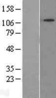 Western Blot: SNX13 Overexpression Lysate (Adult Normal) [NBL1-16304] Left-Empty vector transfected control cell lysate (HEK293 cell lysate); Right -Over-expression Lysate for SNX13.