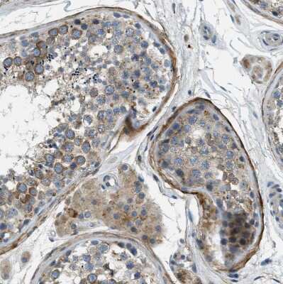 Immunohistochemistry-Paraffin: SNX14 Antibody [NBP1-80838] - Staining of human testis shows weak to moderate cytoplasmic positivity in cells in seminiferous ducts.