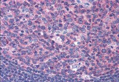 Immunohistochemistry-Paraffin SNX16 Antibody