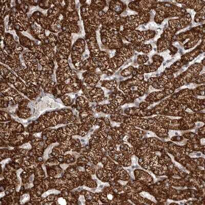 Immunohistochemistry-Paraffin: SNX16 Antibody [NBP1-85972] - Staining of human liver shows strong cytoplasmic positivity in hepatocytes.