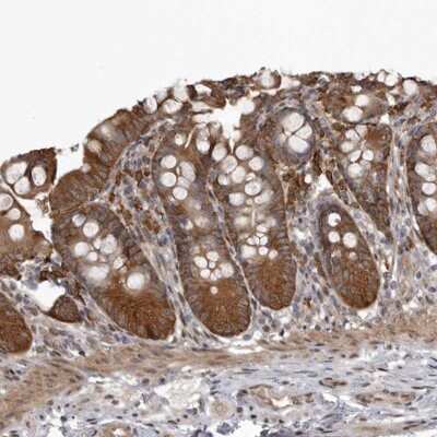 Immunohistochemistry-Paraffin SNX16 Antibody - BSA Free