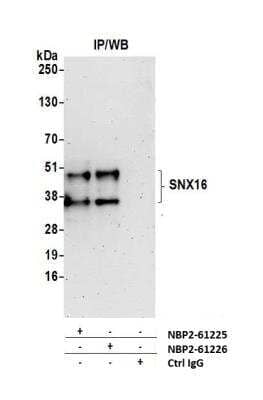 Immunoprecipitation: SNX16 Antibody [NBP2-61225] - Detection of Human SNX16 by Western Blot of Immunoprecipitates. Samples: Whole cell lysate (1.0 mg per IP reaction; 20% of IP loaded) from Jurkat cells prepared using NETN lysis buffer. Antibodies: Affinity purified rabbit anti-SNX16 antibody NBP2-61225 used for IP at 20 ul per reaction. SNX16 was also immunoprecipitated by rabbit anti-SNX16 antibody NBP2-61226. For blotting immunoprecipitated SNX16, NBP2-61225 was used at 1:250. Detection: Chemiluminescence with an exposure time of 3 minutes.