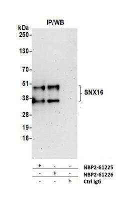 Immunoprecipitation: SNX16 Antibody [NBP2-61226] - Detection of Human SNX16 by Western Blot of Immunoprecipitates. Samples: Whole cell lysate (1.0 mg per IP reaction; 20% of IP loaded) from Jurkat cells prepared using NETN lysis buffer. Antibodies: Affinity purified rabbit anti-SNX16 antibody NBP2-61225 used for IP at 20 ul per reaction. SNX16 was also immunoprecipitated by rabbit anti-SNX16 antibody NBP2-61226. For blotting immunoprecipitated SNX16, NBP2-61225 was used at 1:250. Detection: Chemiluminescence with an exposure time of 3 minutes.