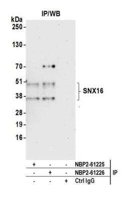 Immunoprecipitation: SNX16 Antibody [NBP2-61226] - Detection of human SNX16 by western blot of immunoprecipitates. Samples: Whole cell lysate (1.0 mg per IP reaction; 20% of IP loaded) from Jurkat cells prepared using NETN lysis buffer. Antibodies: Affinity purified rabbit anti-SNX16 antibody NBP2-61226 used for IP at 8 ul per reaction. SNX16 was also immunoprecipitated by rabbit anti-SNX16 antibody NBP2-61225. For blotting immunoprecipitated SNX16, NBP2-61226 was used at 1:1000. Detection: Chemiluminescence with an exposure time of 30 seconds.