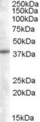 Western Blot SNX16 Antibody