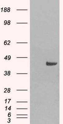 Western Blot SNX16 Antibody