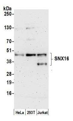 Western Blot: SNX16 Antibody [NBP2-61225] - Detection of human SNX16 by western blot. Samples: Whole cell lysate (50 ug) from HeLa, HEK293T, and Jurkat cells prepared using NETN lysis buffer. Antibody: Affinity purified rabbit anti-SNX16 antibody NBP2-61225 used for WB at 1:1000. Detection: Chemiluminescence with an exposure time of 3 minutes.