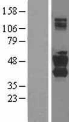 Western Blot SNX16 Overexpression Lysate