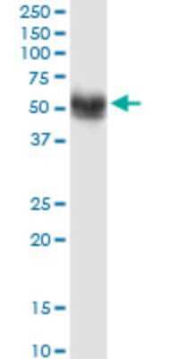 Western Blot: SNX17 Antibody (2A3) [H00009784-M01] - SNX17 monoclonal antibody (M01), clone 2A3. Analysis of SNX17 expression in human kidney.