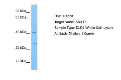 Western Blot: SNX17 Antibody [NBP2-88326] - Host: Rabbit. Target Name: SNX17. Sample Tissue: Human DLD1 Whole Cell. Antibody Dilution: 1.0ug/ml