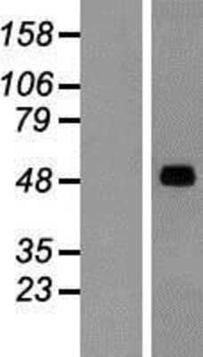 Western Blot: SNX17 Overexpression Lysate (Adult Normal) [NBP2-07282] Left-Empty vector transfected control cell lysate (HEK293 cell lysate); Right -Over-expression Lysate for SNX17.