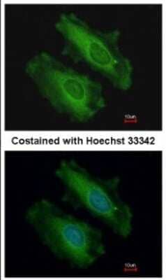 Immunocytochemistry/Immunofluorescence: SNX18 Antibody [NBP2-20443] - Immunofluorescence analysis of methanol-fixed HeLa, using antibody at 1:200 dilution.