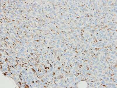 Immunohistochemistry-Paraffin: SNX18 Antibody [NBP1-33089] - Paraffin-embedded MDAMB231 xenograft, using antibody at 1:500 dilution.