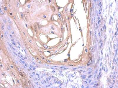 Immunohistochemistry-Paraffin: SNX18 Antibody [NBP2-20443] - cal27 xenograft, using SNX18 antibody at 1:500 dilution. Antigen Retrieval: Trilogy™ (EDTA based, pH 8.0) buffer, 15min.