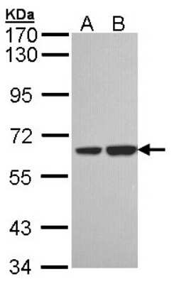 Western Blot: SNX18 Antibody [NBP1-33089] - Sample (30 ug of whole cell lysate) A: H1299 B: Hela 7.5% SDS PAGE; antibody diluted at 1:1000.