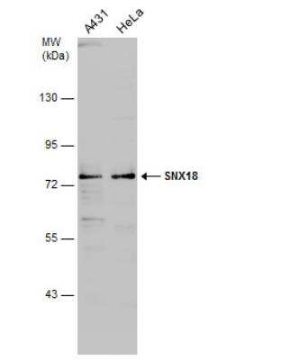 Western Blot: SNX18 Antibody [NBP2-20444] - Various whole cell extracts (30 ug) were separated by 7.5% SDS-PAGE, and the membrane was blotted with SNX18 antibody [N3C2], Internal diluted at 1:500.
