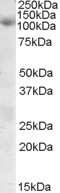 Western Blot: SNX19 Antibody [NBP1-20976] - Analysis of SNX19 in Human Skeletal Muscle lysate (35ug protein in RIPA buffer). Primary incubation was 1 hour. Detected by chemiluminescence using this antibody at 0.3ug/ml. Primary incubation was 1 hour. Detected by chemiluminescence.