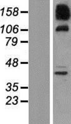 Western Blot: SNX19 Overexpression Lysate (Adult Normal) [NBP2-07278] Left-Empty vector transfected control cell lysate (HEK293 cell lysate); Right -Over-expression Lysate for SNX19.