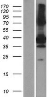 Western Blot: SNX20 Overexpression Lysate (Adult Normal) [NBP2-04818] Left-Empty vector transfected control cell lysate (HEK293 cell lysate); Right -Over-expression Lysate for SNX20.