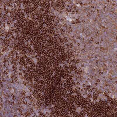 Immunohistochemistry-Paraffin: SNX21 Antibody [NBP1-92419] - Staining of human tonsil shows strong cytoplasmic positivity in non-germinal center cells and moderate staining in germinal center cells.