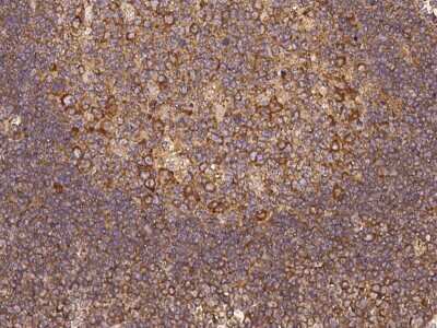 Immunohistochemistry-Paraffin SNX21 Antibody - BSA Free