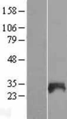 Western Blot: SNX21 Overexpression Lysate (Adult Normal) [NBL1-16311] Left-Empty vector transfected control cell lysate (HEK293 cell lysate); Right -Over-expression Lysate for SNX21.