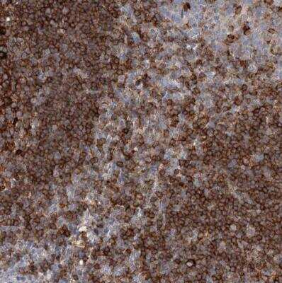 Immunohistochemistry-Paraffin: SNX22 Antibody [NBP1-82244] - Staining of human tonsil shows strong cytoplasmic positivity in germinal center cells and non-germinal center cells.