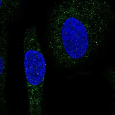 Immunocytochemistry/Immunofluorescence: SNX24 Antibody [NBP2-56620] - Staining of human cell line U-2 OS shows localization to vesicles.