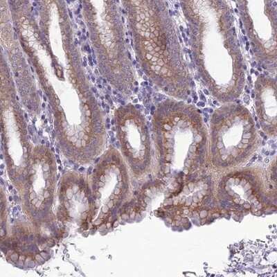 Immunohistochemistry-Paraffin: SNX24 Antibody [NBP1-80785] - Staining of human stomach, upper shows moderate cytoplasmic positivity in glandular cells.