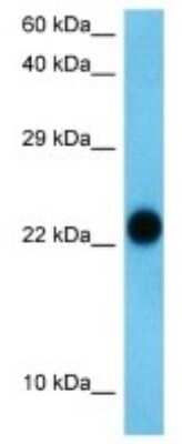 Western Blot: SNX24 Antibody [NBP3-09968] - Western blot analysis of SNX24 in 293T Whole Cell. Antibody dilution at 1.0ug/ml