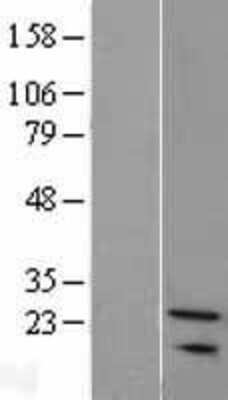 Western Blot: SNX24 Overexpression Lysate (Adult Normal) [NBL1-16312] Left-Empty vector transfected control cell lysate (HEK293 cell lysate); Right -Over-expression Lysate for SNX24.