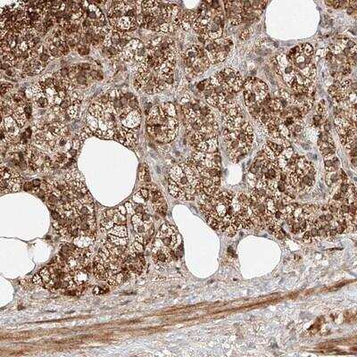 Immunohistochemistry: SNX26 Antibody [NBP1-92421] - Staining of human adrenal gland shows cytoplasmic positivity in cortical cells.