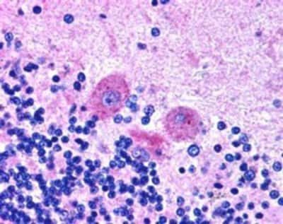 Immunohistochemistry-Paraffin: SNX26 Antibody [NB100-1219] - Staining of paraffin embedded Human Brain with antibody at 2.5 ug/mL shows cytoplasm staining of Purkinje cells in cerebellum. Steamed antigen retrieval with citrate buffer pH 6, AP-staining.
