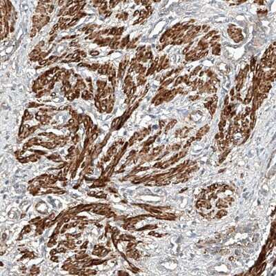 Immunohistochemistry-Paraffin: SNX26 Antibody [NBP1-92420] - Staining of human smooth muscle shows strong cytoplasmic positivity in smooth muscle cells.
