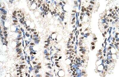 Immunohistochemistry-Paraffin: SNX29 Antibody [NBP1-79261] - Human Intestine Tissue, antibody concentration 4-8ug/ml. Cells with positive label: Epithelial cells of intestinal villus (indicated with arrows) 400X magnification.