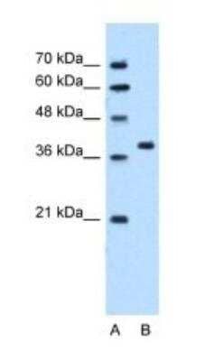 Western Blot: SNX29 Antibody [NBP1-79261] - Titration: 5.0ug/ml Positive Control: HepG2 cell lysate.